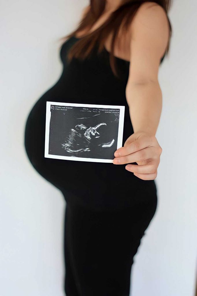 عکس بارداری